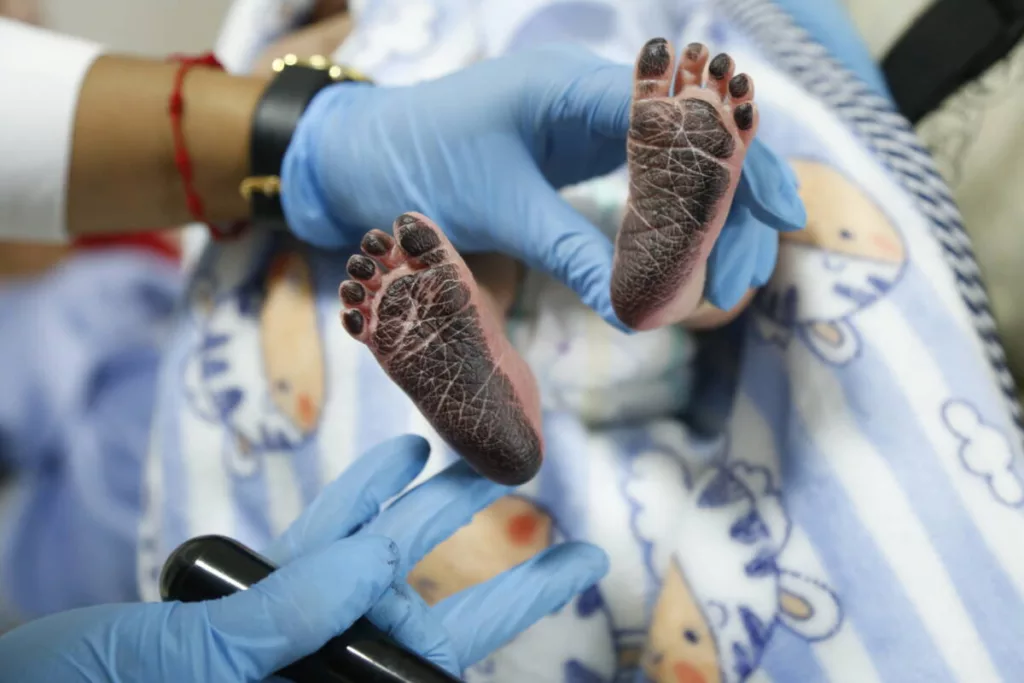 Con los ‘Brazos abiertos’ Colombia garantiza protección a niños venezolanos nacidos en el país